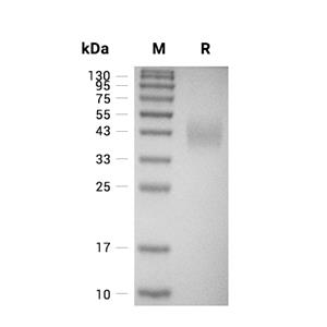 IFN-gamma R2蛋白, Mouse (HEK293, His, solution)