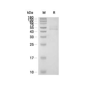 MRAP蛋白, Human (HEK293, hFc)