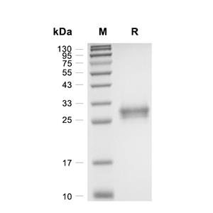 PGD2 Synthase/PTGDS蛋白, Mouse (HEK293, His)