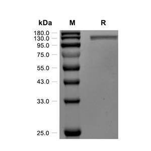 NCAM-1/CD56蛋白, Rat (HEK293, His)