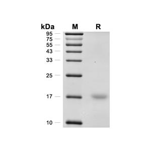 ENSA蛋白, Human (His)