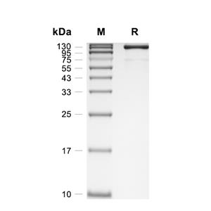 Contactin-3/CNTN3蛋白, Human (N708D, HEK293, His)