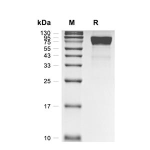 Coagulation Factor IX/F9蛋白, Mouse (HEK293, His)
