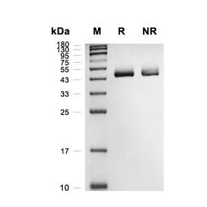 ACPP/Prostatic Acid Phosphatase蛋白, Mouse (HEK293, His)
