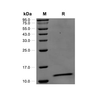 S100A10蛋白, Human (His)