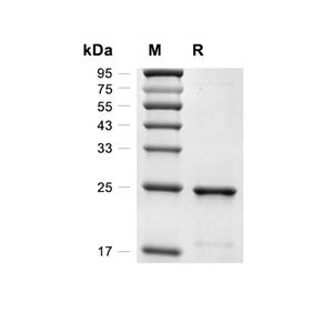 RGS5蛋白, Human (His)