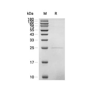 PRDX1蛋白, Mouse (His)