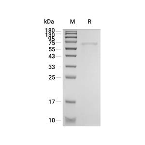 HSP60蛋白, Mouse (His, solution),HSP60 Protein, Mouse (His, solution)
