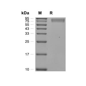 NA/Neuraminidase蛋白, H1N1 (AYV62750, HEK293, His)