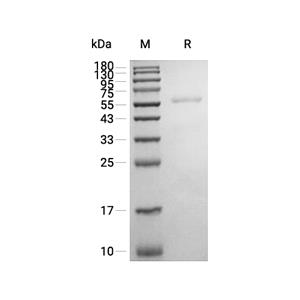 Dectin-2/CLEC6A蛋白, Human (HEK293, Fc)