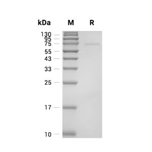 HEXB/Hexosaminidase B蛋白, Human (HEK293, His)