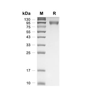 FLT3蛋白, Human (T227M, HEK293, His),FLT3 Protein, Human (T227M, HEK293, His)
