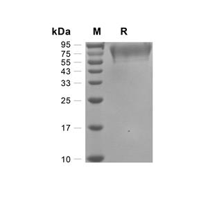 CADM1/IGSF4A蛋白, Human (HEK293, His)