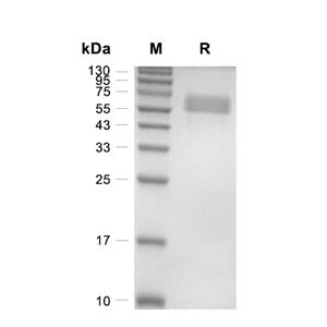 ACVR2A/Activin RIIA蛋白, Human/Cynomolgus (HEK293, Fc)