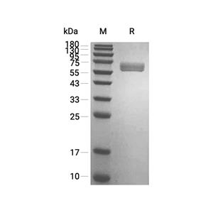 CD131蛋白, Human (HEK293, His)