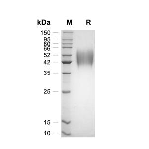 CD200R1蛋白, Mouse (HEK293, His)