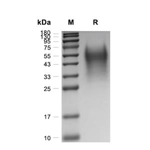 IL-18BP蛋白, Mouse (HEK293, His),IL-18BP Protein, Mouse (HEK293, His)