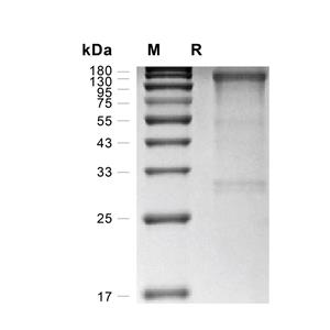 IL-31R alpha蛋白, Human (HEK293, Fc)