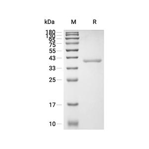 Epiregulin蛋白, Mouse (HEK293, hFc)