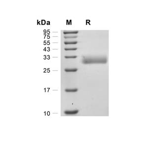 Ephrin B3蛋白, Mouse (HEK293, His)