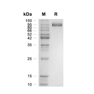EphB2蛋白, Mouse (HEK293, Fc),EphB2 Protein, Mouse (HEK293, Fc)