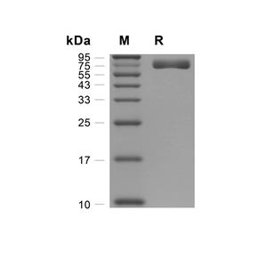 EphA4蛋白, Rat (HEK293, His)