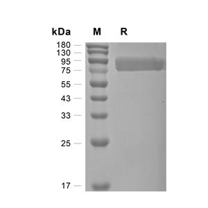 EphA2蛋白, Mouse (HEK293, His)