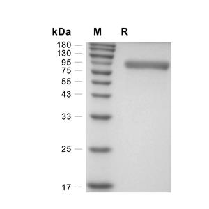 EphA1蛋白, Mouse (HEK293, His)