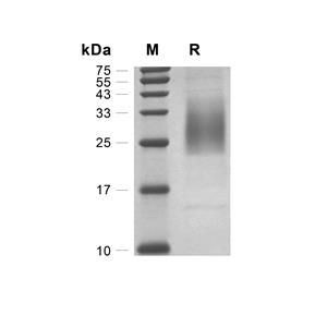 CD47蛋白, Rat (HEK293, His)