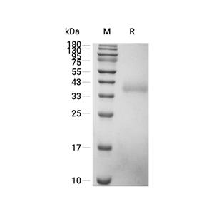 CD2蛋白, Cynomolgus/Rhesus Macaque (HEK293, His, solution),CD2 Protein, Cynomolgus/Rhesus Macaque (HEK293, His, solution)