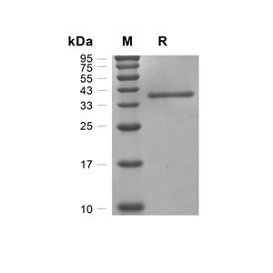 Cathepsin Z/CTSZ蛋白, Mouse (HEK293, His)