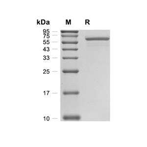 Arylsulfatase A/ARSA蛋白, Mouse (HEK293, His),Arylsulfatase A/ARSA Protein, Mouse (HEK293, His)