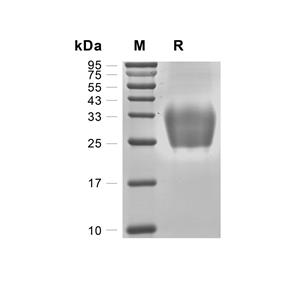 ACVR2B蛋白, Mouse (HEK293, His)