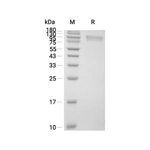 gp130/IL6ST蛋白, Human (HEK293),gp130/IL6ST Protein, Human (HEK293)