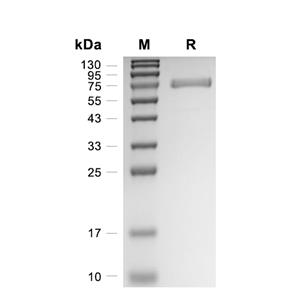 GBA/Glucosylceramidase蛋白, Human (HEK293, His)