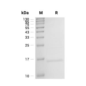 FABP5蛋白, Human,FABP5 Protein, Human