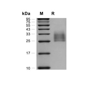 Ephrin-B2/EFNB2蛋白, Canine (HEK293, His)