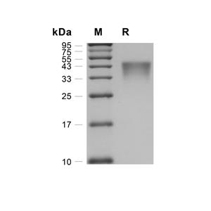 DAP10蛋白, Human (HEK293, mFc)
