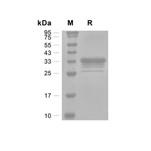 IFI30蛋白, Human (HEK293, His)