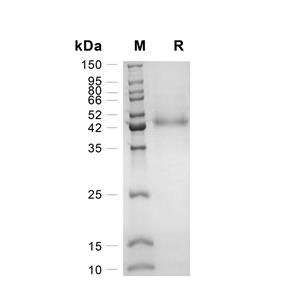 IL-13R alpha 2蛋白, Human (HEK293, His)