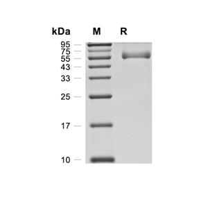 RAB1B蛋白, Human (HEK293, Fc),RAB1B Protein, Human (HEK293, Fc)