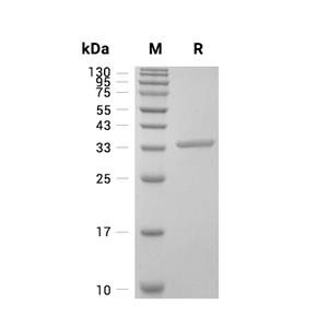 IdeS蛋白, Streptococcus pyogenes (His, solution)