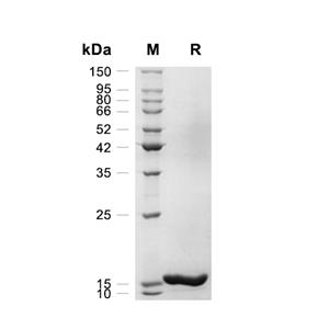 FABP4蛋白, Mouse (His),FABP4 Protein, Mouse (His)
