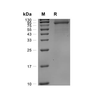 HSP70/HSPA1A蛋白, Human (HEK293, His)