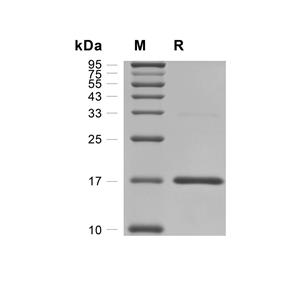 HBP1蛋白, Human (His),HBP1 Protein, Human (His)