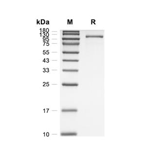 GRIK2蛋白, Human (HEK293, hFc),GRIK2 Protein, Human (HEK293, hFc)
