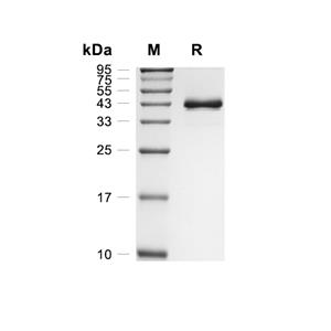 GDNF蛋白, Canine (HEK293, Fc)