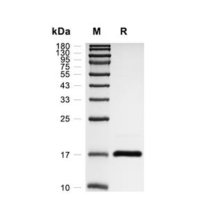 FHIT蛋白, Human (His)