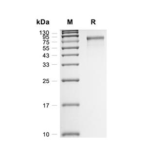 ECM1蛋白, Mouse (HEK293, His),ECM1 Protein, Mouse (HEK293, His)