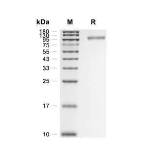 DR6/TNFRSF21蛋白, Rat (HEK293, Fc),DR6/TNFRSF21 Protein, Rat (HEK293, Fc)